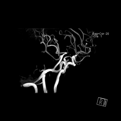 Click on the Serie image to view the images of VILLANUEVA, WILLIAM A.